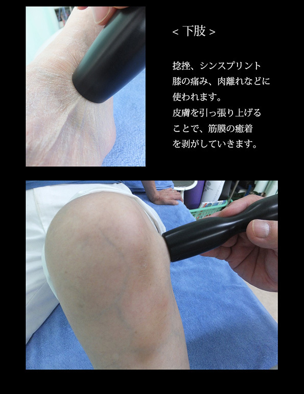 下肢施術例03.jpg