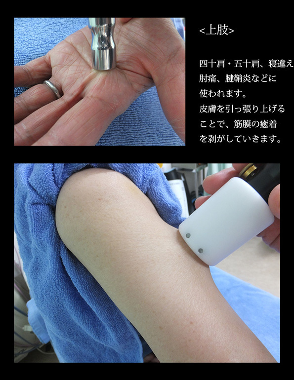 上肢施術例03.jpg